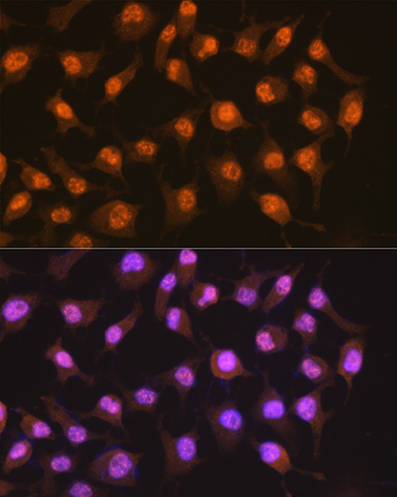 PER2 Rabbit monoclonal antibody