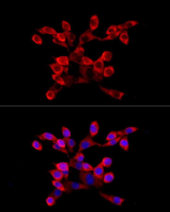 LARP4 Rabbit polyclonal antibody