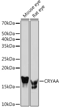 CRYAA Rabbit monoclonal antibody