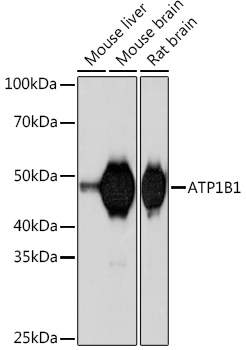 ATP1B1 Rabbit monoclonal antibody