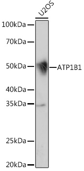 ATP1B1 Rabbit monoclonal antibody