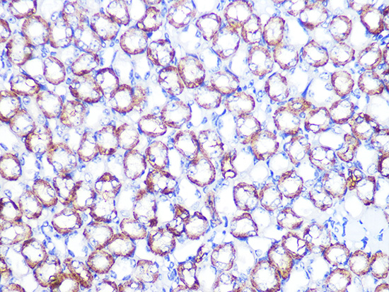 ATP1B1 Rabbit monoclonal antibody