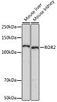 Western blot - ROR2 Rabbit mAb (A5120)