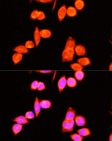 DNAJC19 Rabbit polyclonal antibody