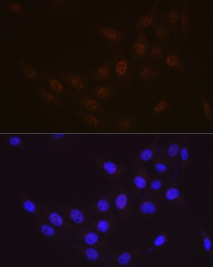 Rad23A Rabbit monoclonal antibody