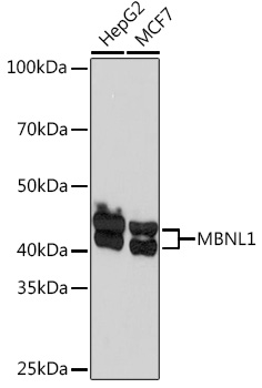 MBNL1 Rabbit monoclonal antibody