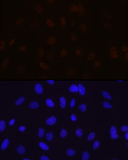 MBNL1 Rabbit monoclonal antibody