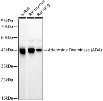 Adenosine Deaminase (ADA) Rabbit monoclonal antibody