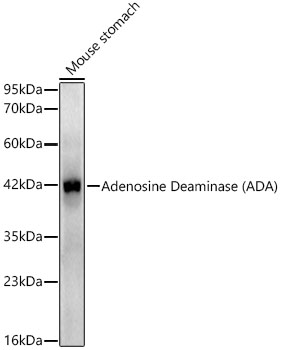Adenosine Deaminase (ADA) Rabbit monoclonal antibody