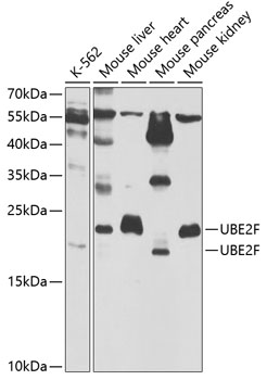 UBE2F Rabbit polyclonal antibody