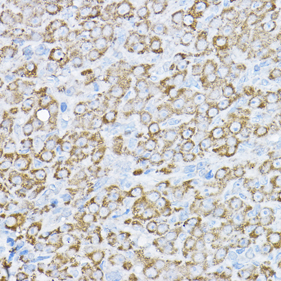 UBE2F Rabbit polyclonal antibody