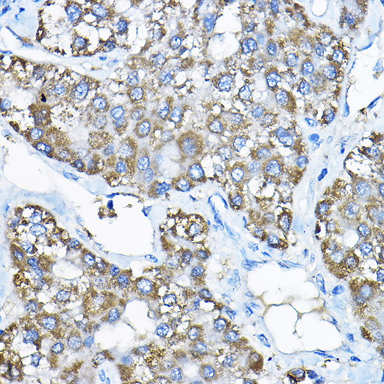 UBE2F Rabbit polyclonal antibody