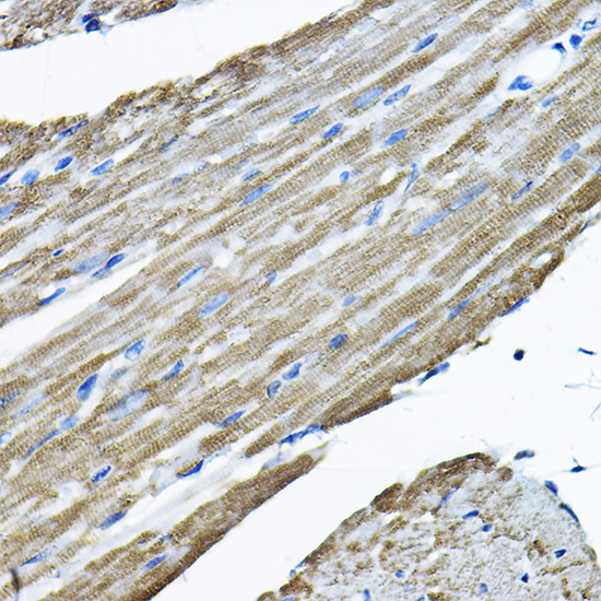 UBE2F Rabbit polyclonal antibody