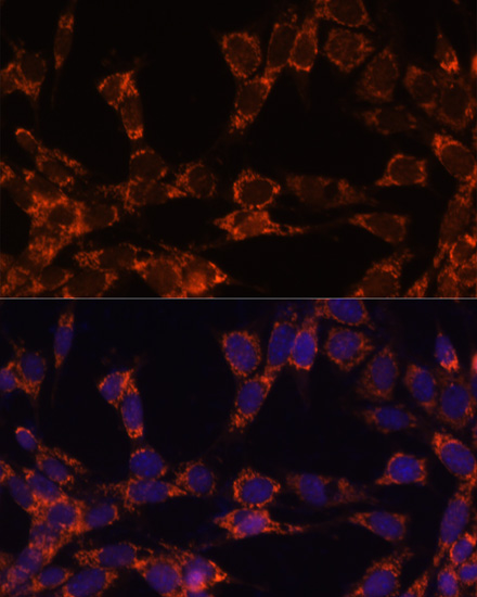 UBE2F Rabbit polyclonal antibody