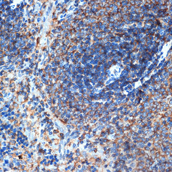 ELMO1 Rabbit monoclonal antibody