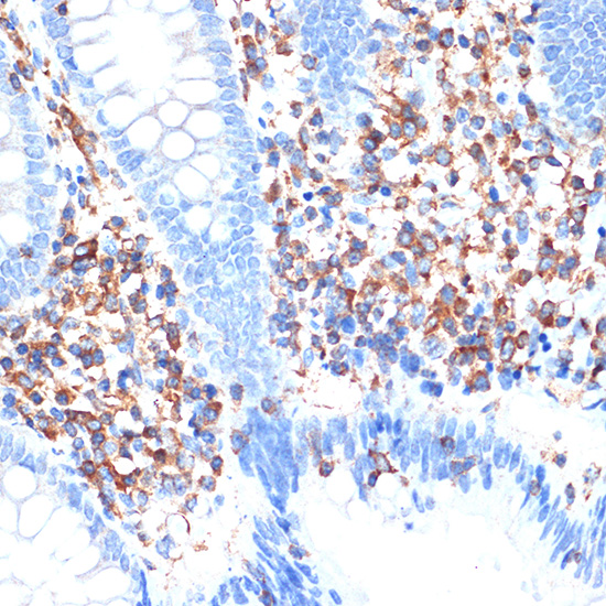 ELMO1 Rabbit monoclonal antibody