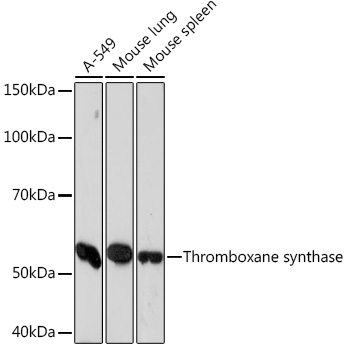 Thromboxane synthase Rabbit mAb