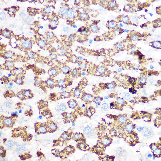 GLUD1 Rabbit monoclonal antibody