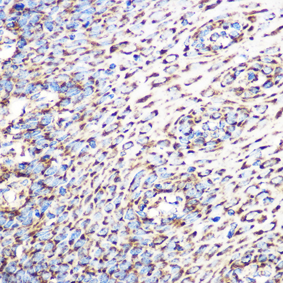GLUD1 Rabbit monoclonal antibody