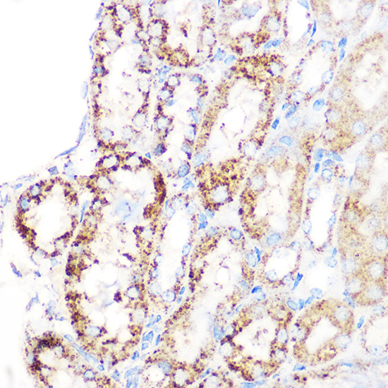 GLUD1 Rabbit monoclonal antibody