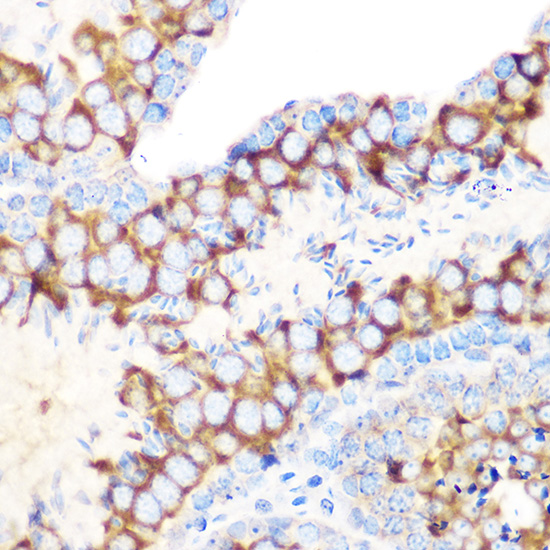RUVBL1/TIP49A/PONTIN Rabbit monoclonal antibody