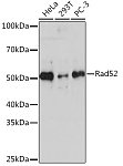 Western blot - Rad52 Rabbit mAb (A5186)