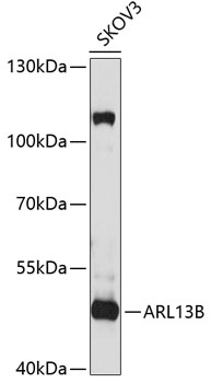 ARL13B Rabbit polyclonal antibody