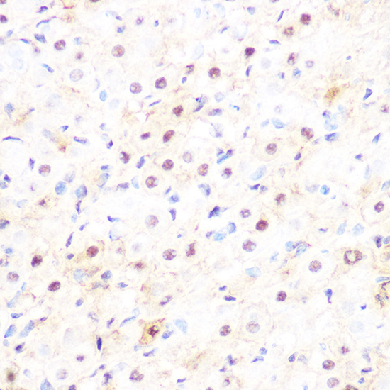DP1/TFDP1 Rabbit monoclonal antibody