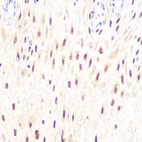 DP1/TFDP1 Rabbit monoclonal antibody