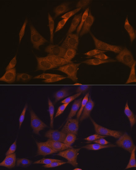 KIFAP3 Rabbit monoclonal antibody