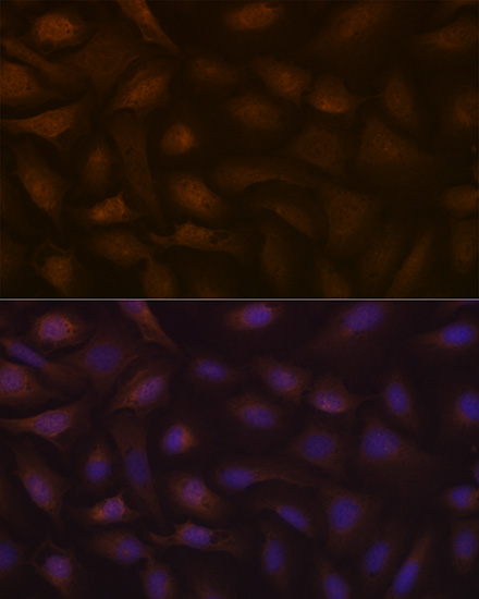 KIFAP3 Rabbit monoclonal antibody