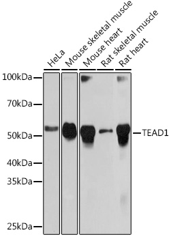 TEAD1 Rabbit monoclonal antibody