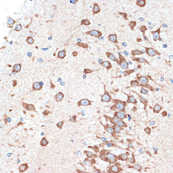 ADORA1 Rabbit monoclonal antibody