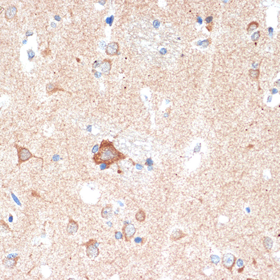 ADORA1 Rabbit monoclonal antibody