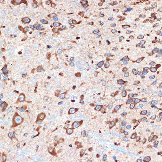ADORA1 Rabbit monoclonal antibody