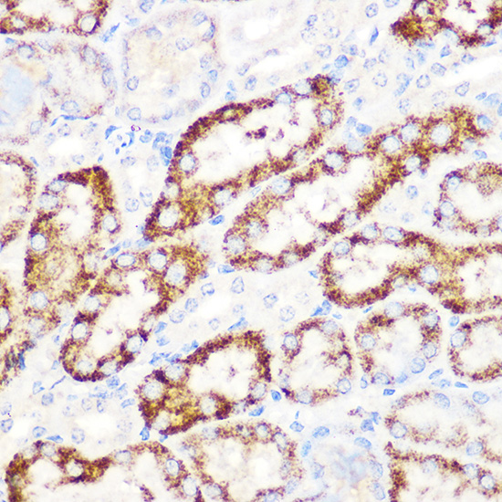 ANGPTL3 Rabbit monoclonal antibody