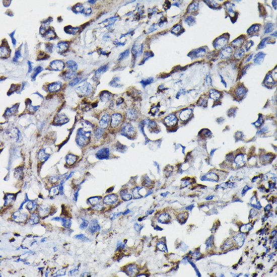 GSTK1 Rabbit polyclonal antibody