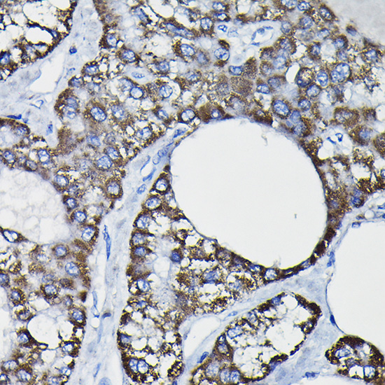 GSTK1 Rabbit polyclonal antibody