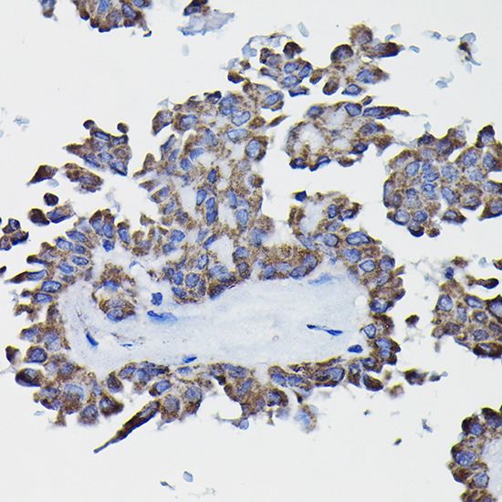 GSTK1 Rabbit polyclonal antibody