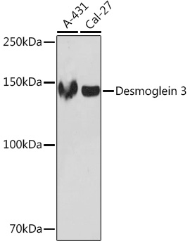Desmoglein 3 Rabbit monoclonal antibody