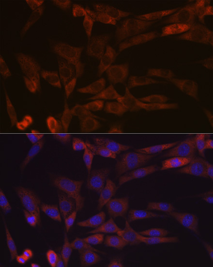 Inhibin beta A (INHBA) Rabbit monoclonal antibody