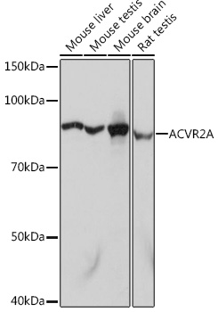 [KO Validated] ACVR2A Rabbit monoclonal antibody