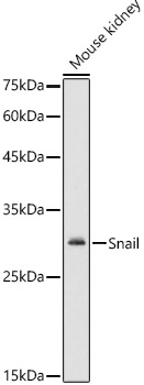 Snail Rabbit polyclonal antibody