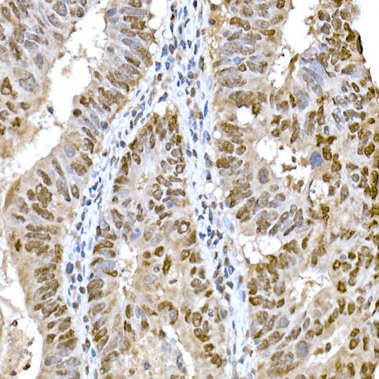 Snail Rabbit polyclonal antibody