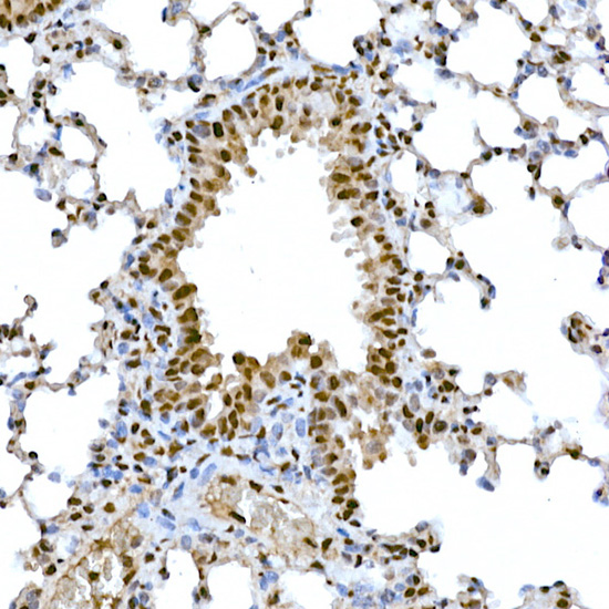 Snail Rabbit polyclonal antibody