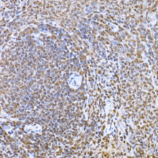 Snail Rabbit polyclonal antibody