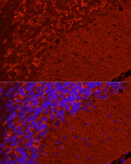 SYN1 Rabbit polyclonal antibody