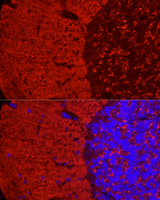 SYN1 Rabbit polyclonal antibody
