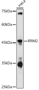 RRM2 Rabbit polyclonal antibody