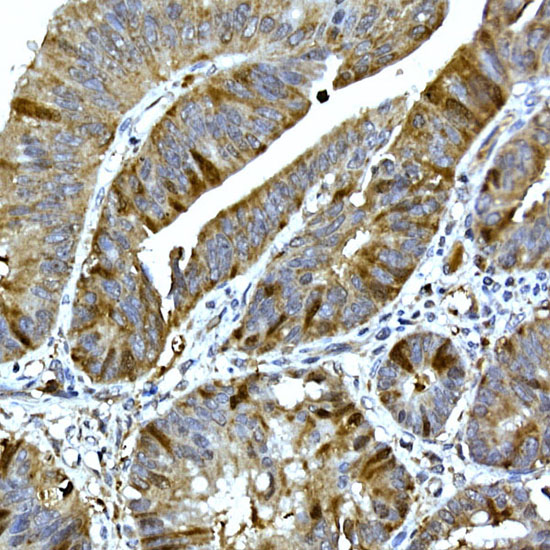 RRM2 Rabbit polyclonal antibody